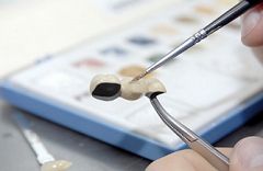 Hochwertiger Zahnersatz Hochwertiger Zahnersatz