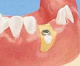 Zahnerhalt Zahnerhalt