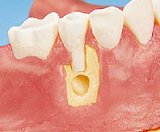 Zahnerhalt Zahnerhalt