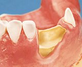 Zahnerhalt Zahnerhalt